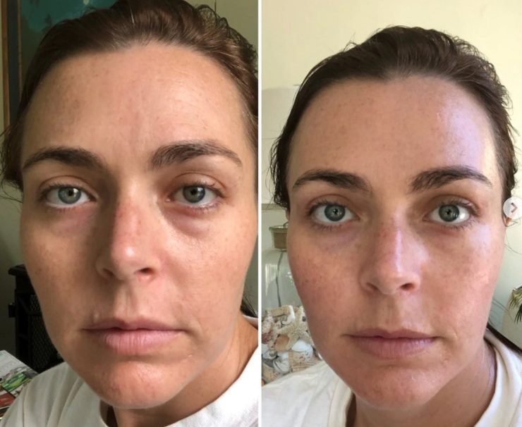 Amanda K. — before and after